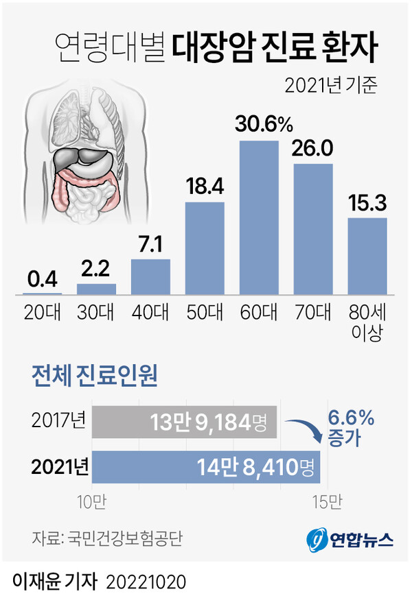 점점 증가하는 대장암과 대장질환, 어떻게 대처해야 할까?